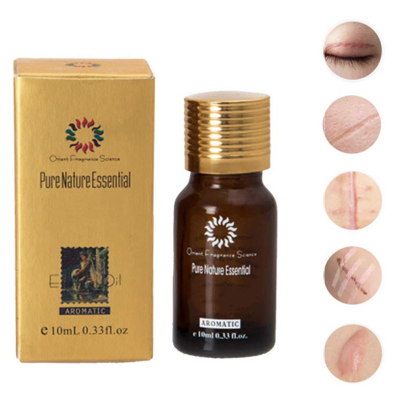 Natural Pure Removal Acne Stretch Marks Scar Removal Essence oil