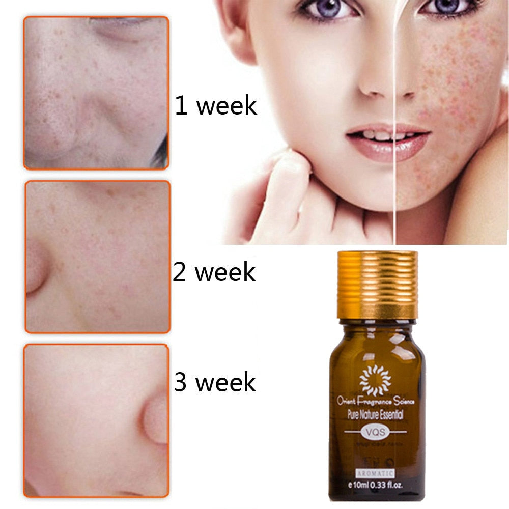 Natural Pure Removal Acne Stretch Marks Scar Removal Essence oil